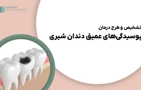 تشخیص و طرح درمان پوسیدگیهای عمیق