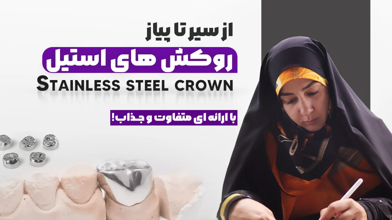 از سیر تا پیاز روکش های استیل (SSC)